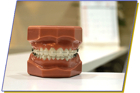 clinica la paz ortodoncia